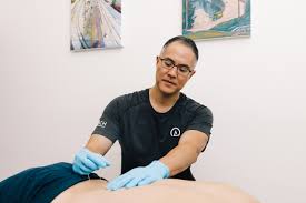 What to Expect During Your First Visit to an Acupuncturist