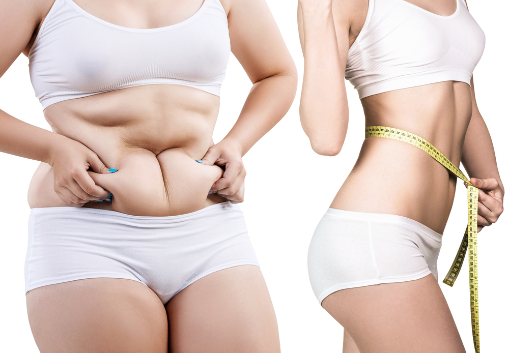 Exploring the Benefits of Medical Weight Loss Programs