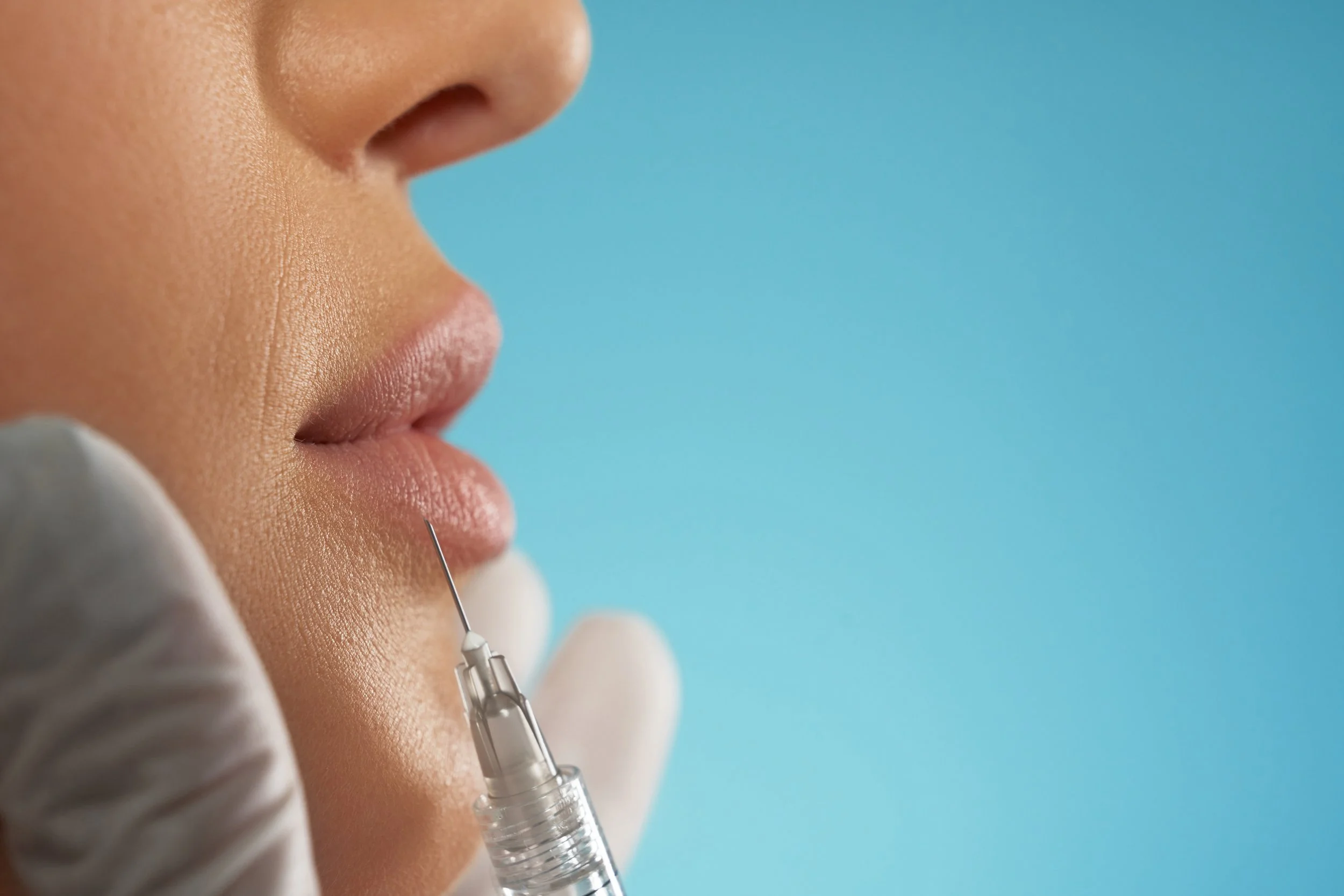The Role of Dermal Fillers in Restoring Volume