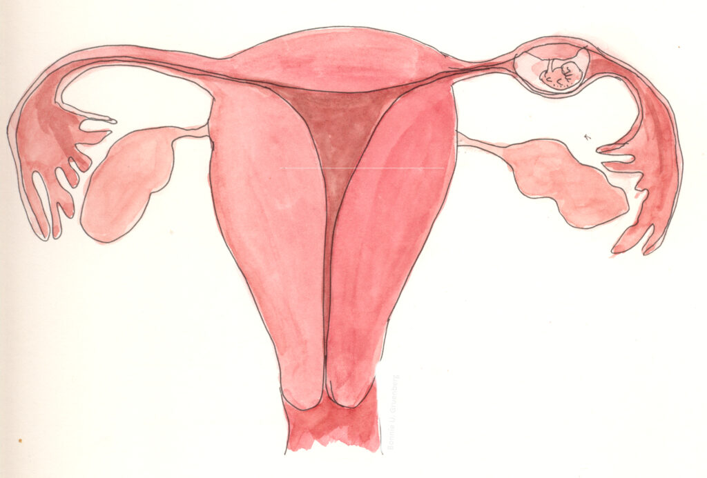 What You Should Know About Tubal Reversal and Ectopic Pregnancies