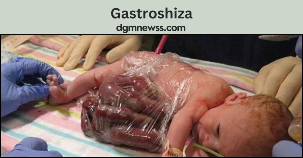 Gastroshiza