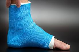 Rehabilitation Exercises After an Ankle Fracture